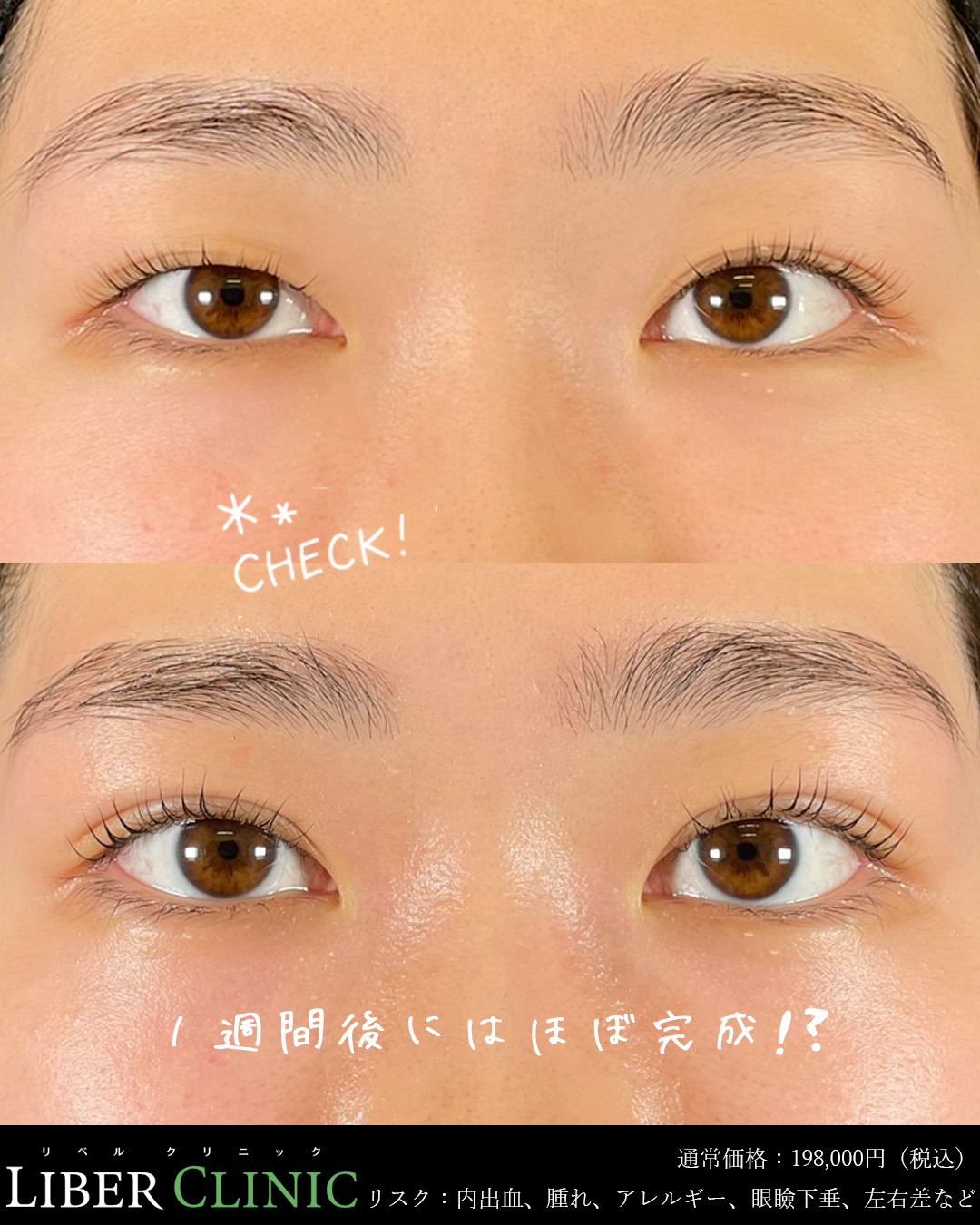1週間後にはほぼ完成！？