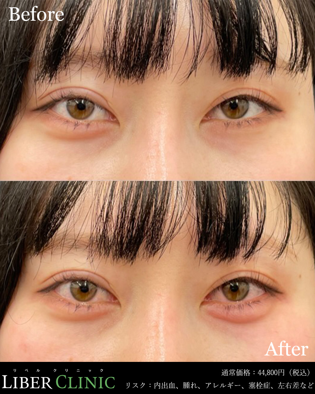 処置前と処置直後の症例