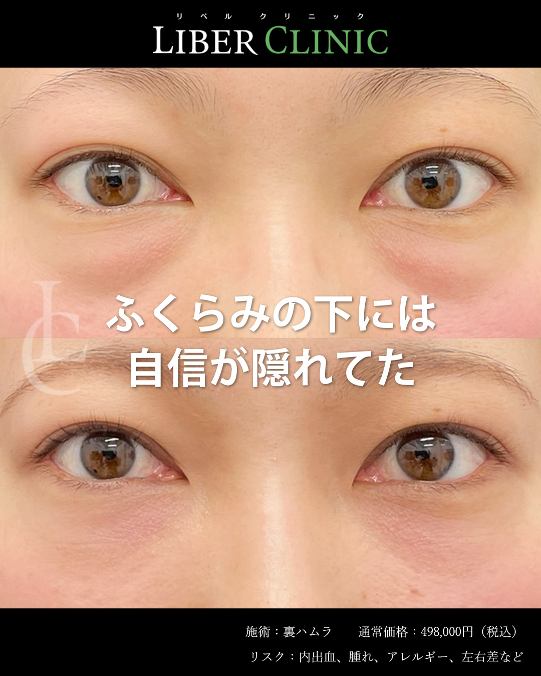 ふくらみの下には自信が隠れてた
