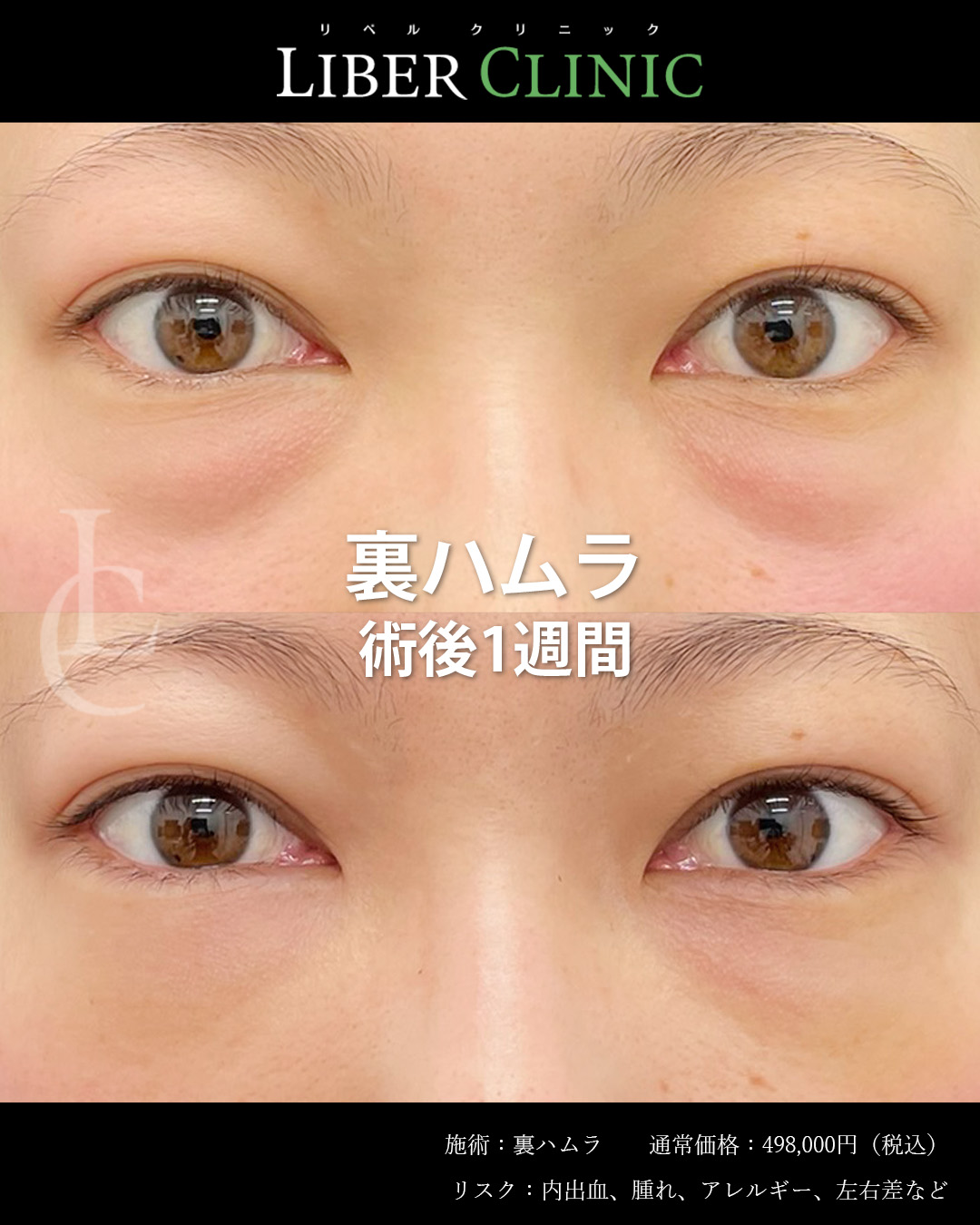 手術前と術後1週間