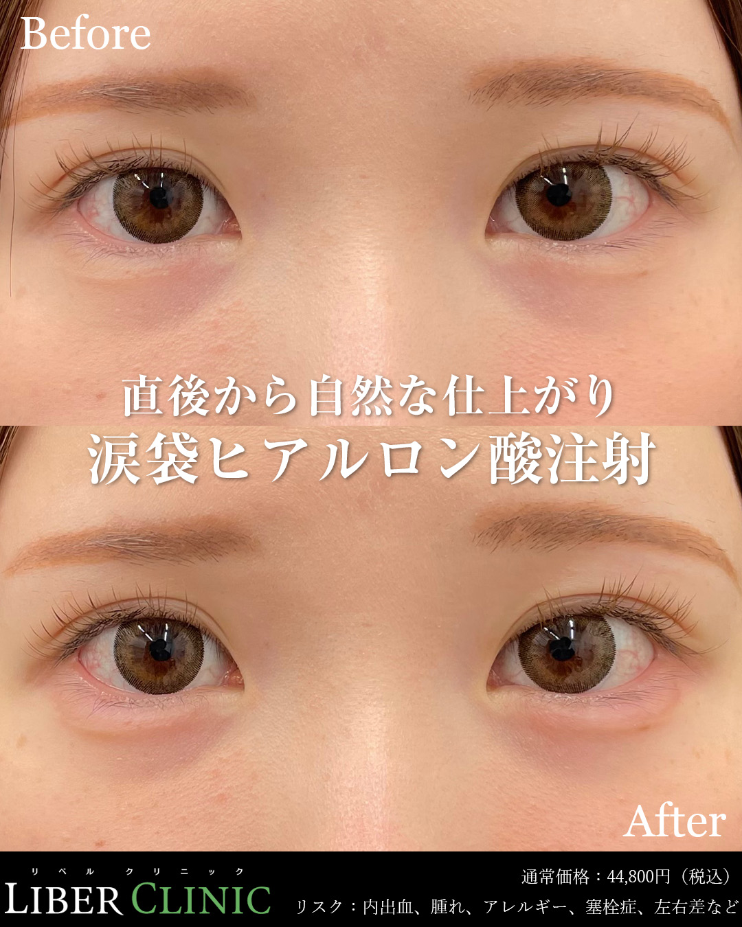 直後から自然な仕上がり！