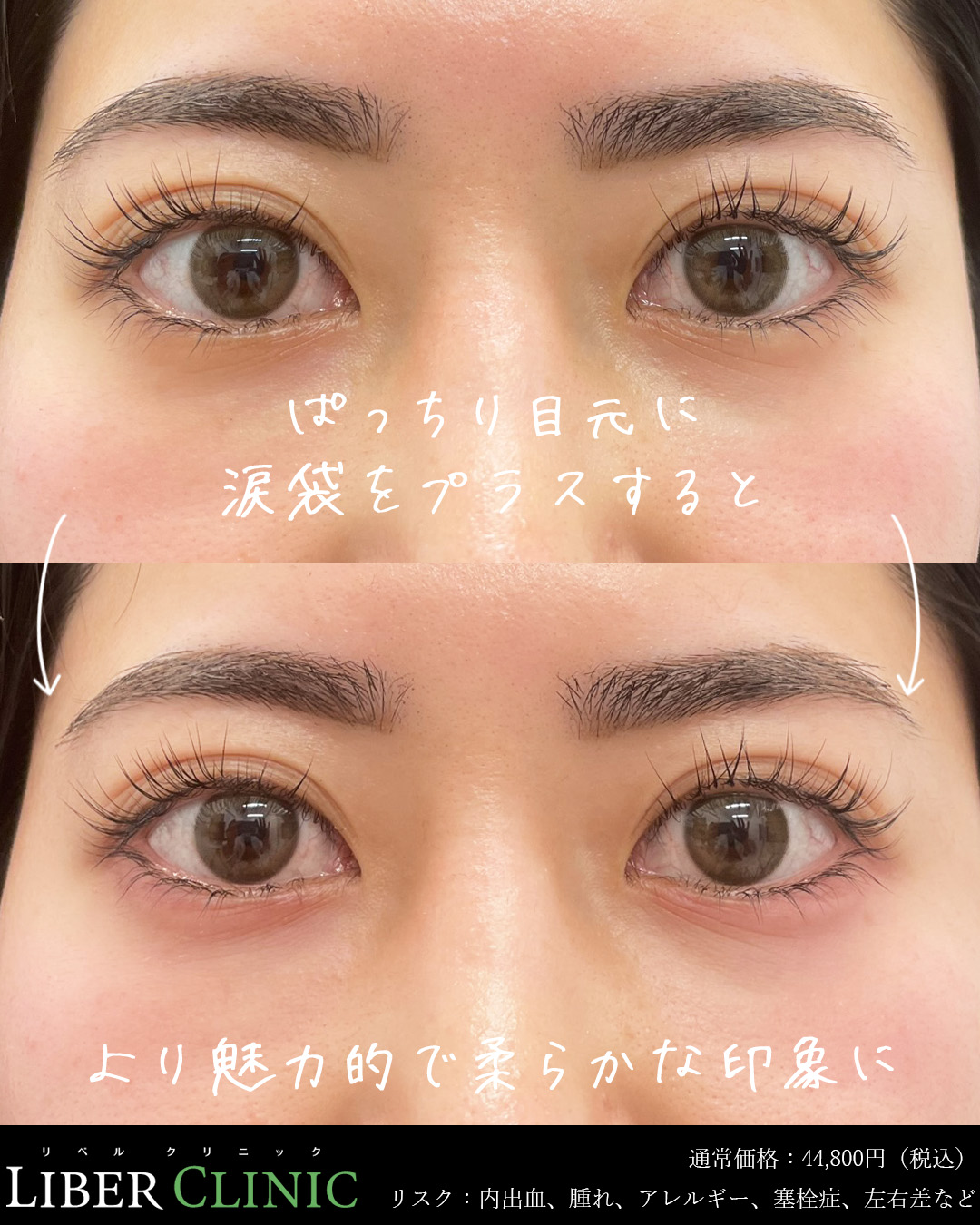 ぱっちり目元に涙袋をプラスすると、より魅力的で柔らかな印象に