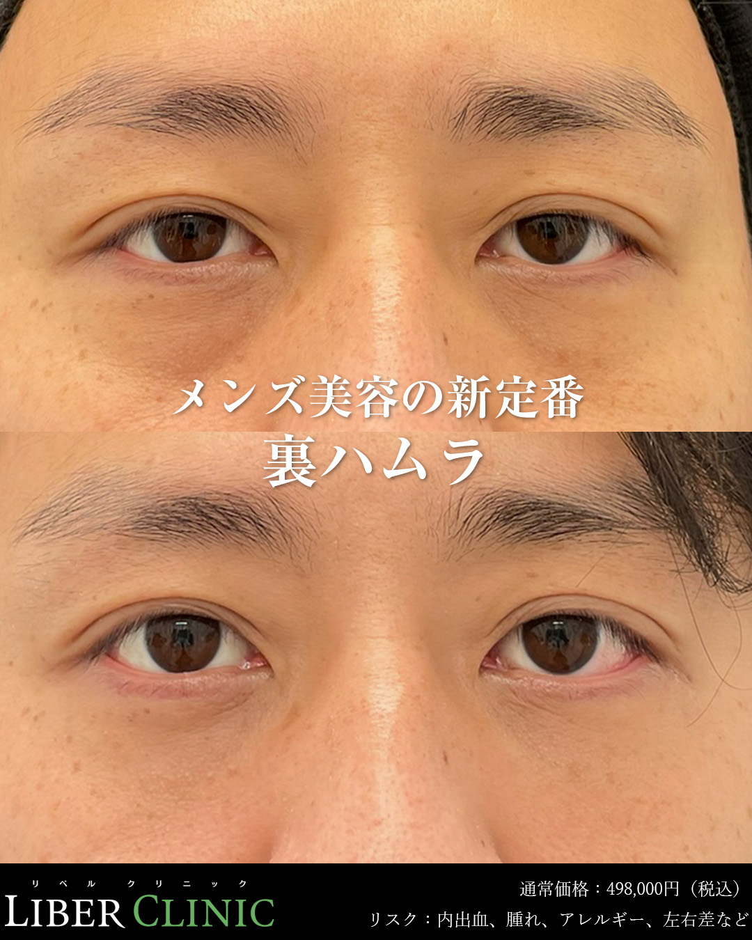 裏ハムラはメンズ美容の新定番