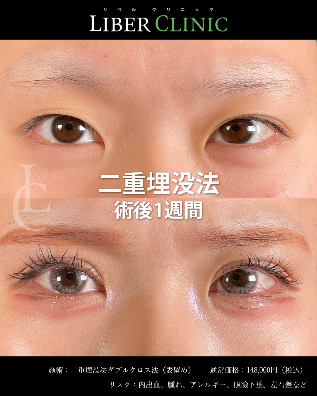 手術前と術後1週間