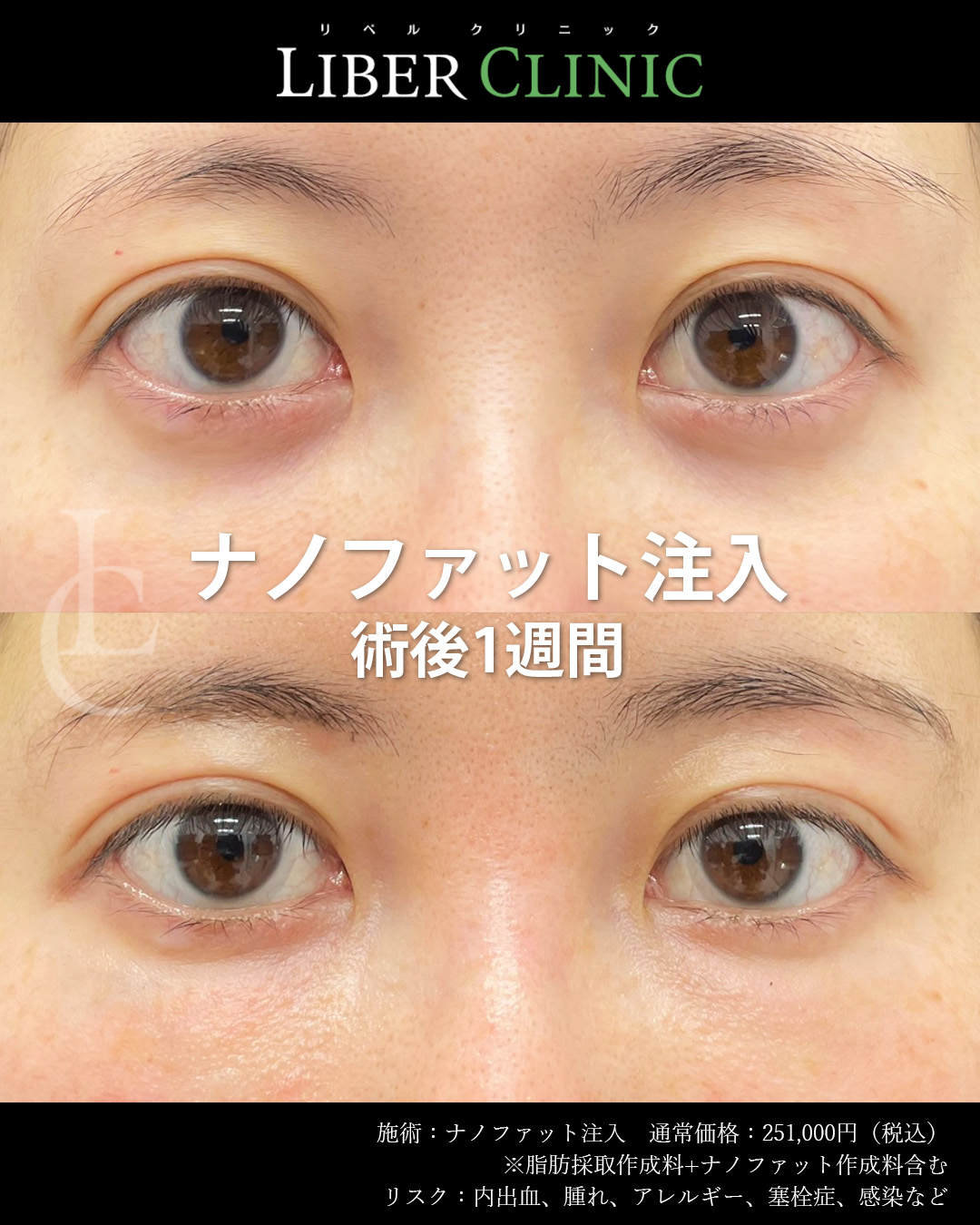 手術前と術後1週間