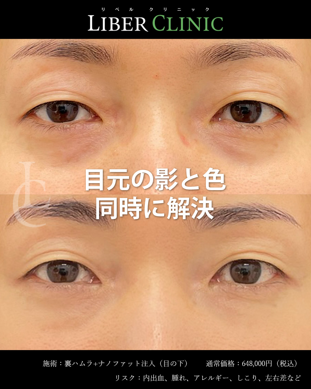目元の影と色を同時に解決