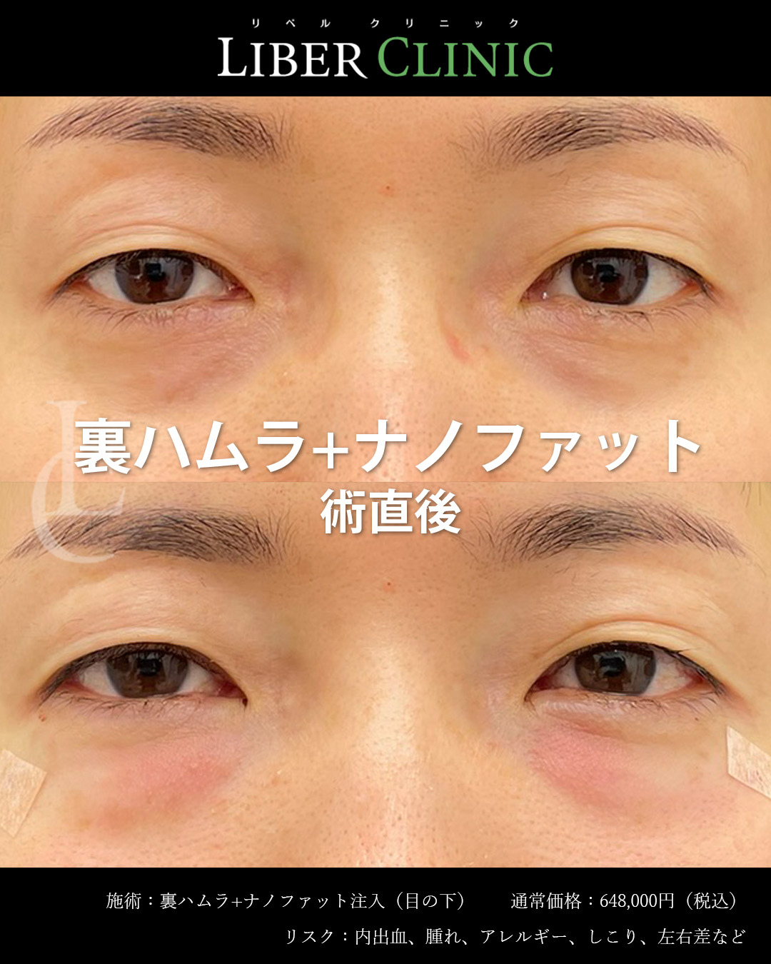 手術前と術直後
