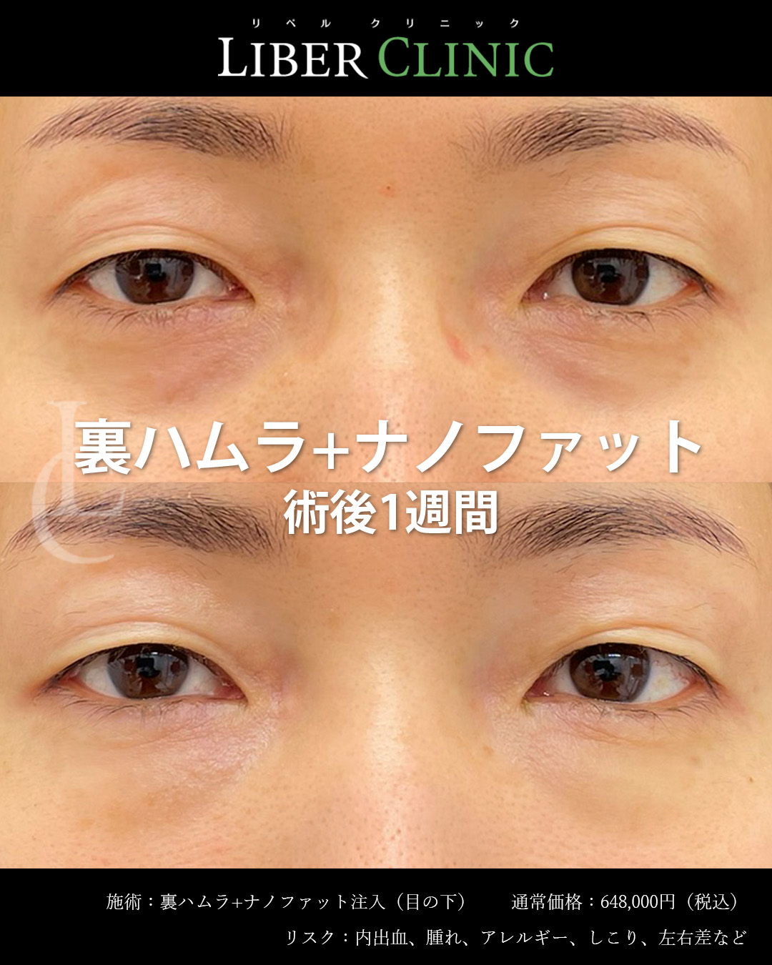 手術前と術後1週間