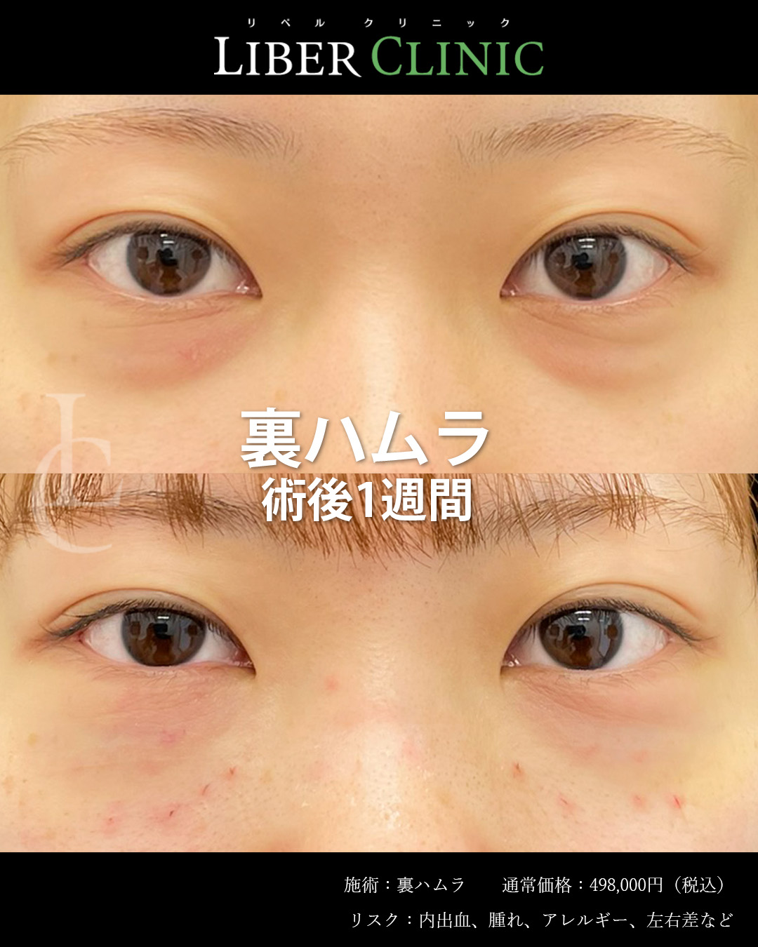 手術前と術後1週間
