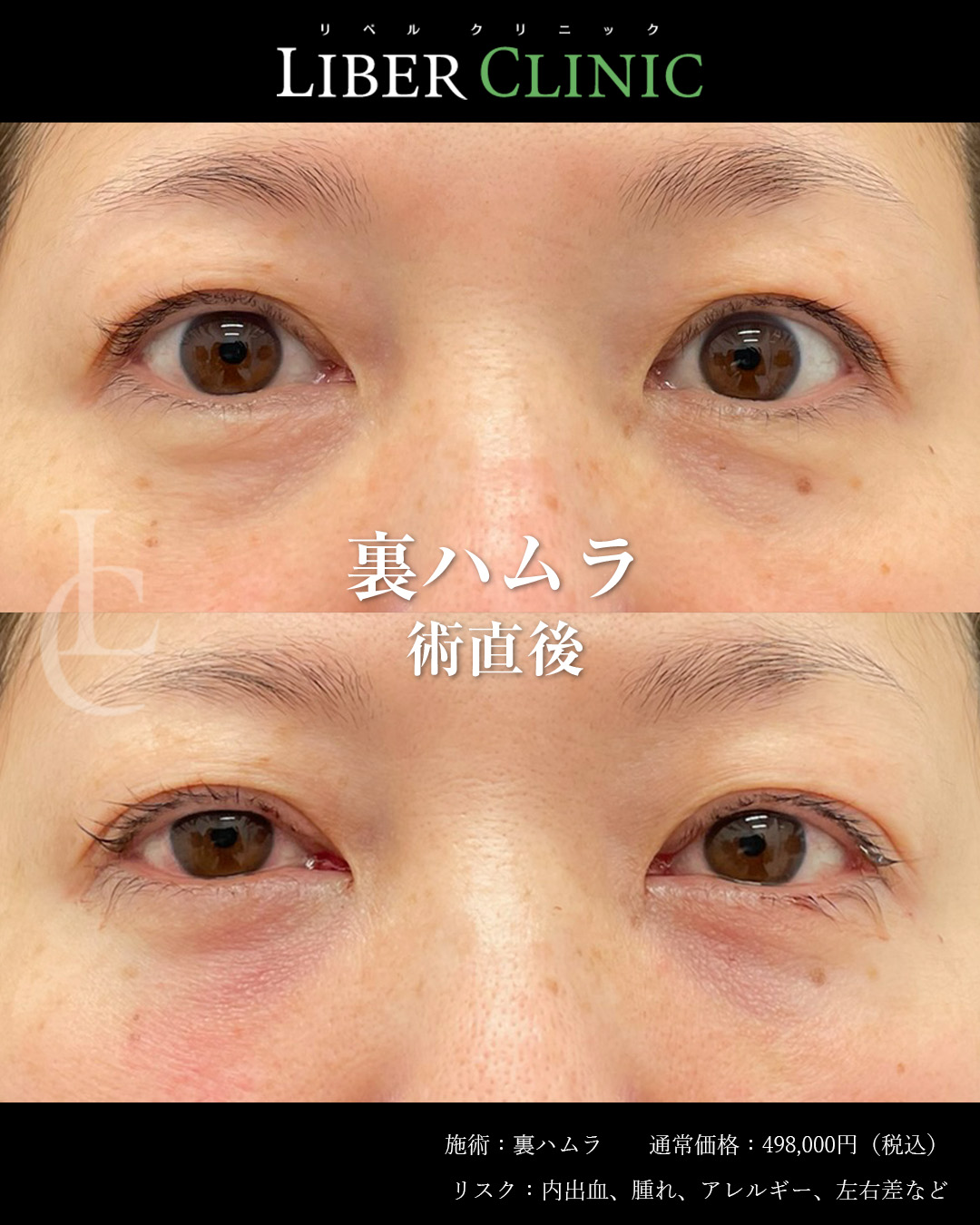 手術前と術直後
