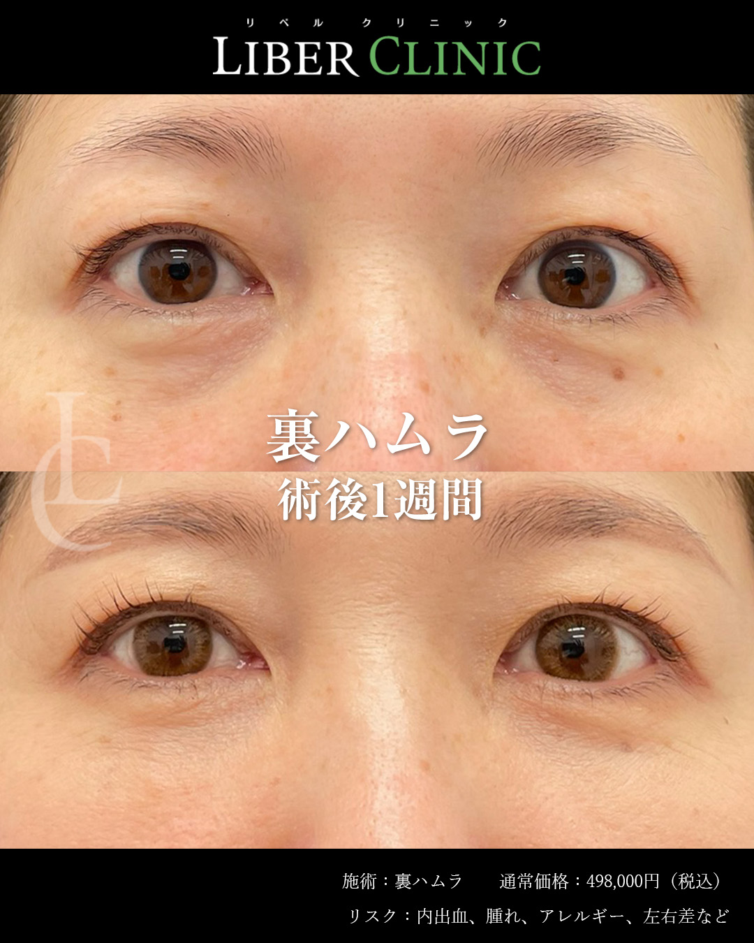 手術前と術後1週間