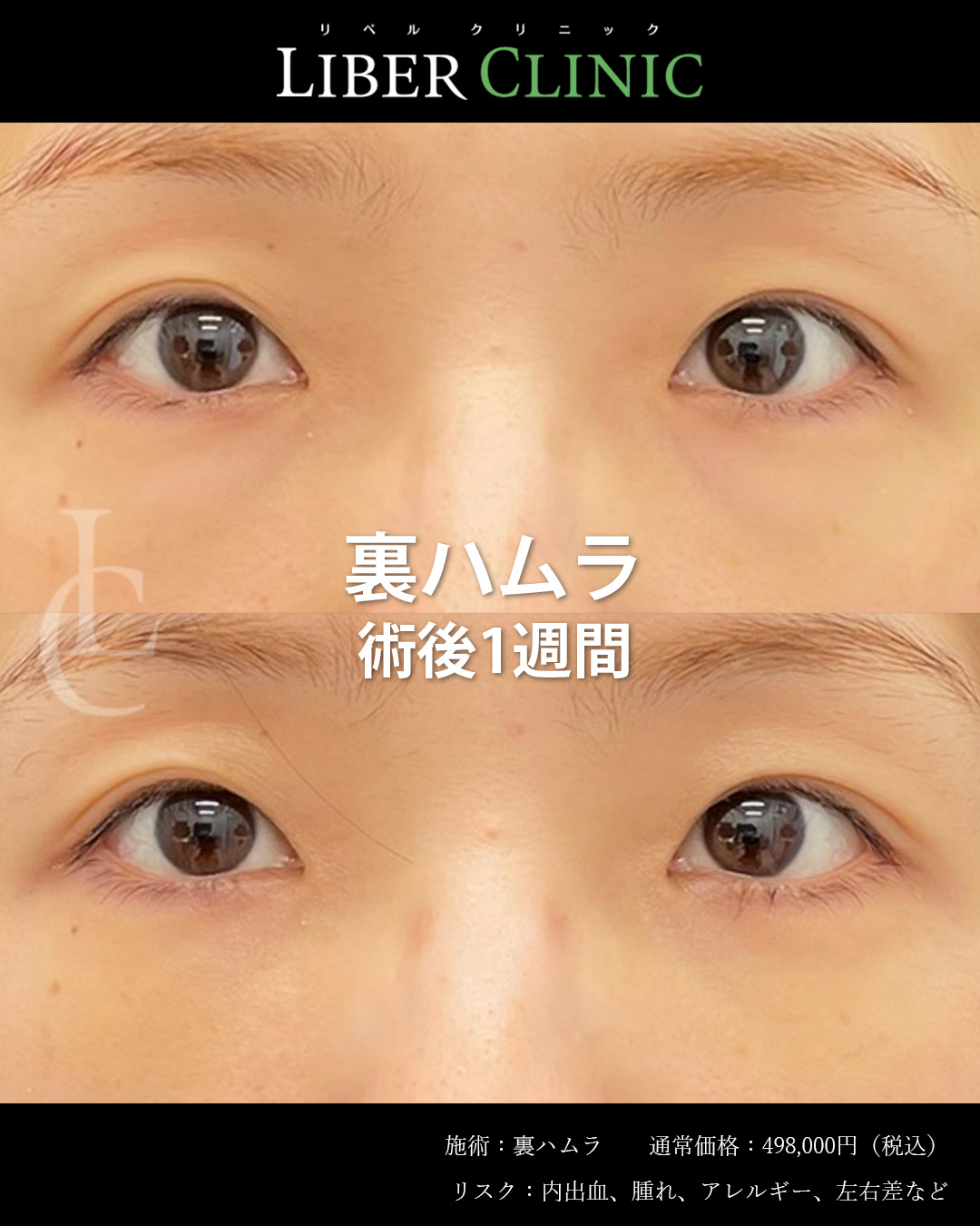 手術前と術後1週間