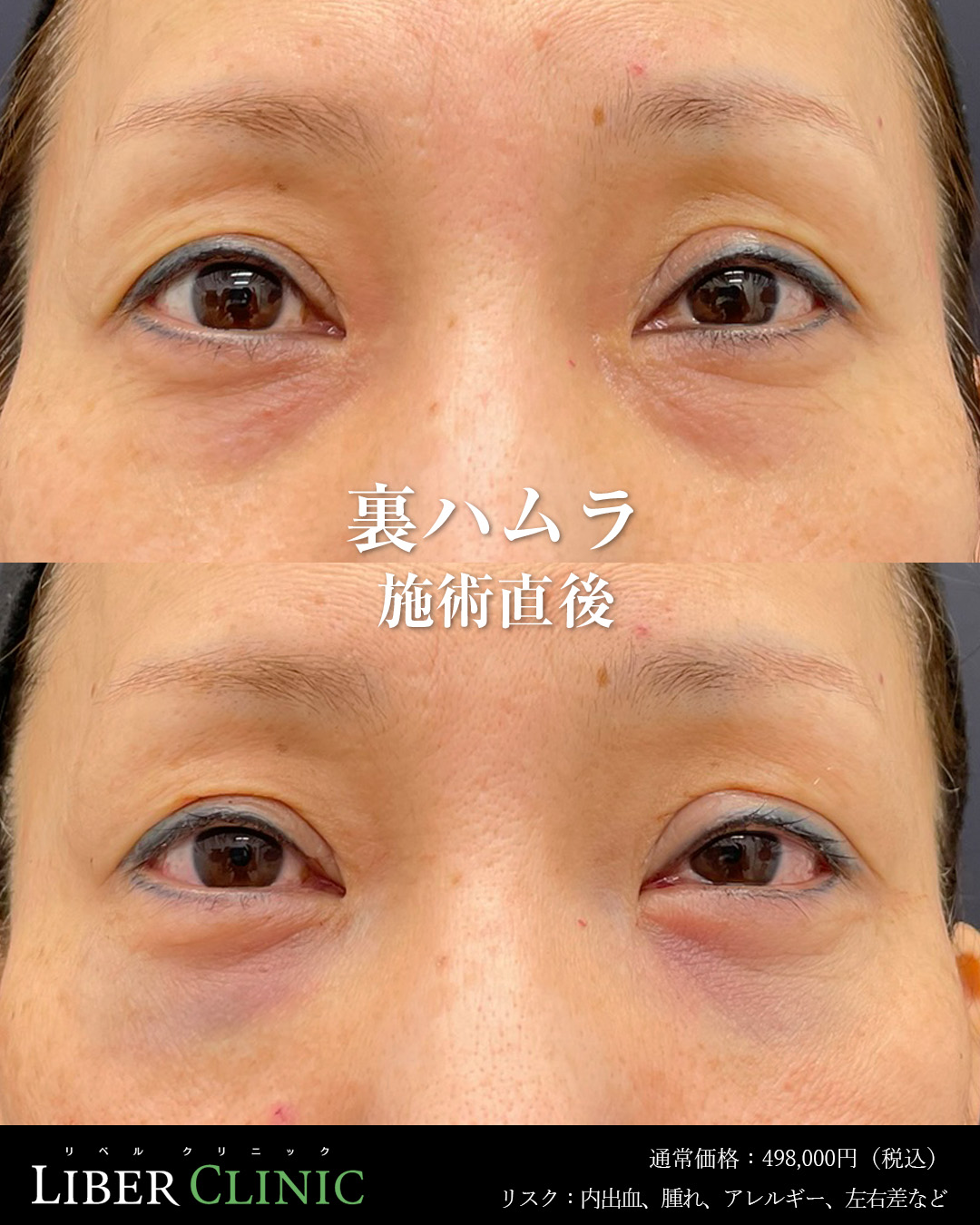 手術前と術直後