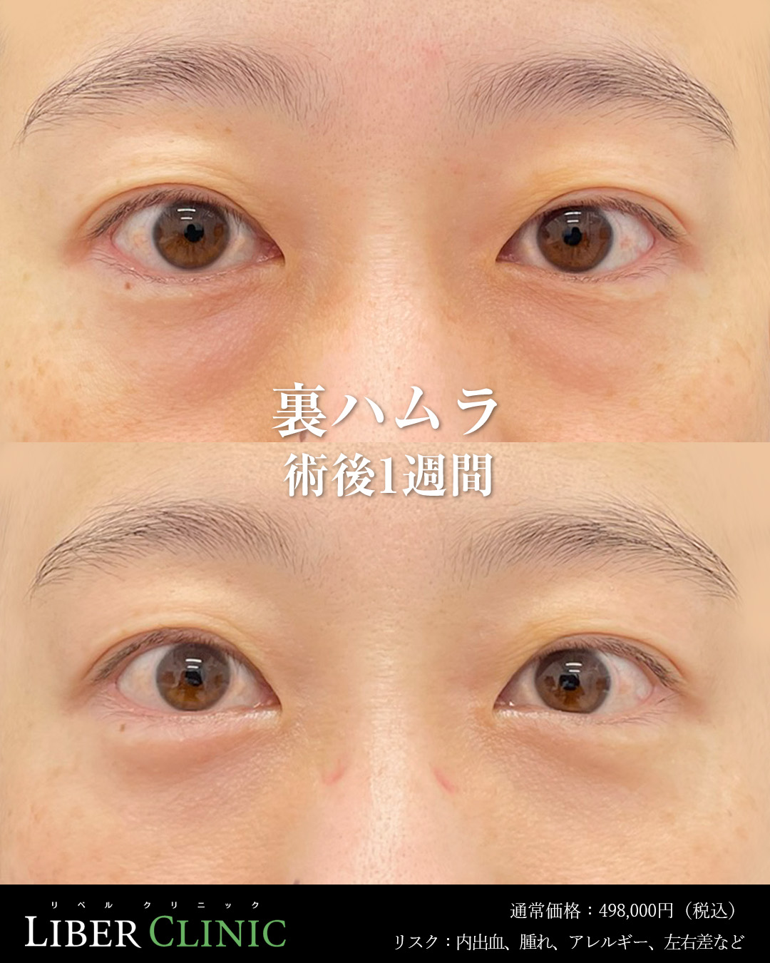 手術前と術後1週間