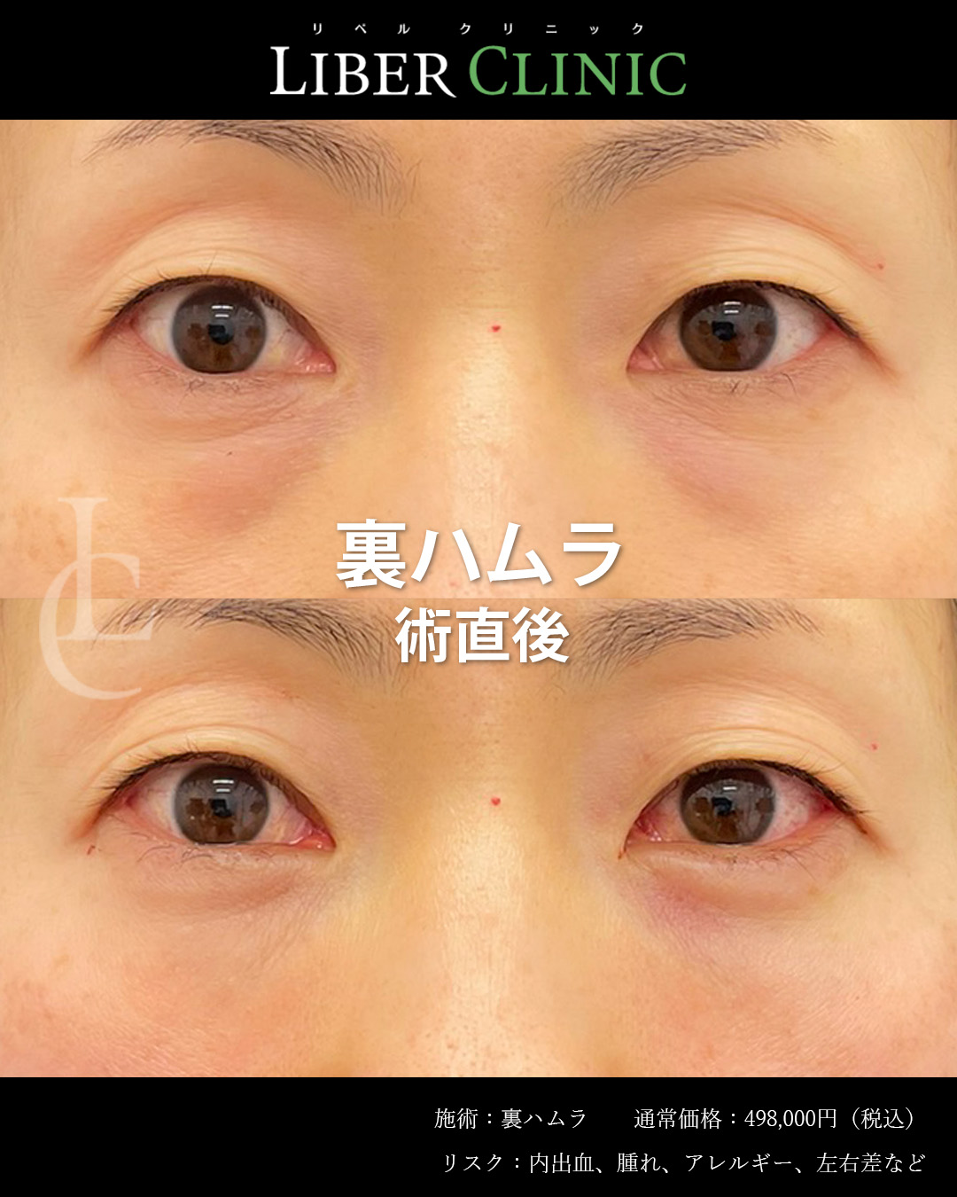 手術前と術直後