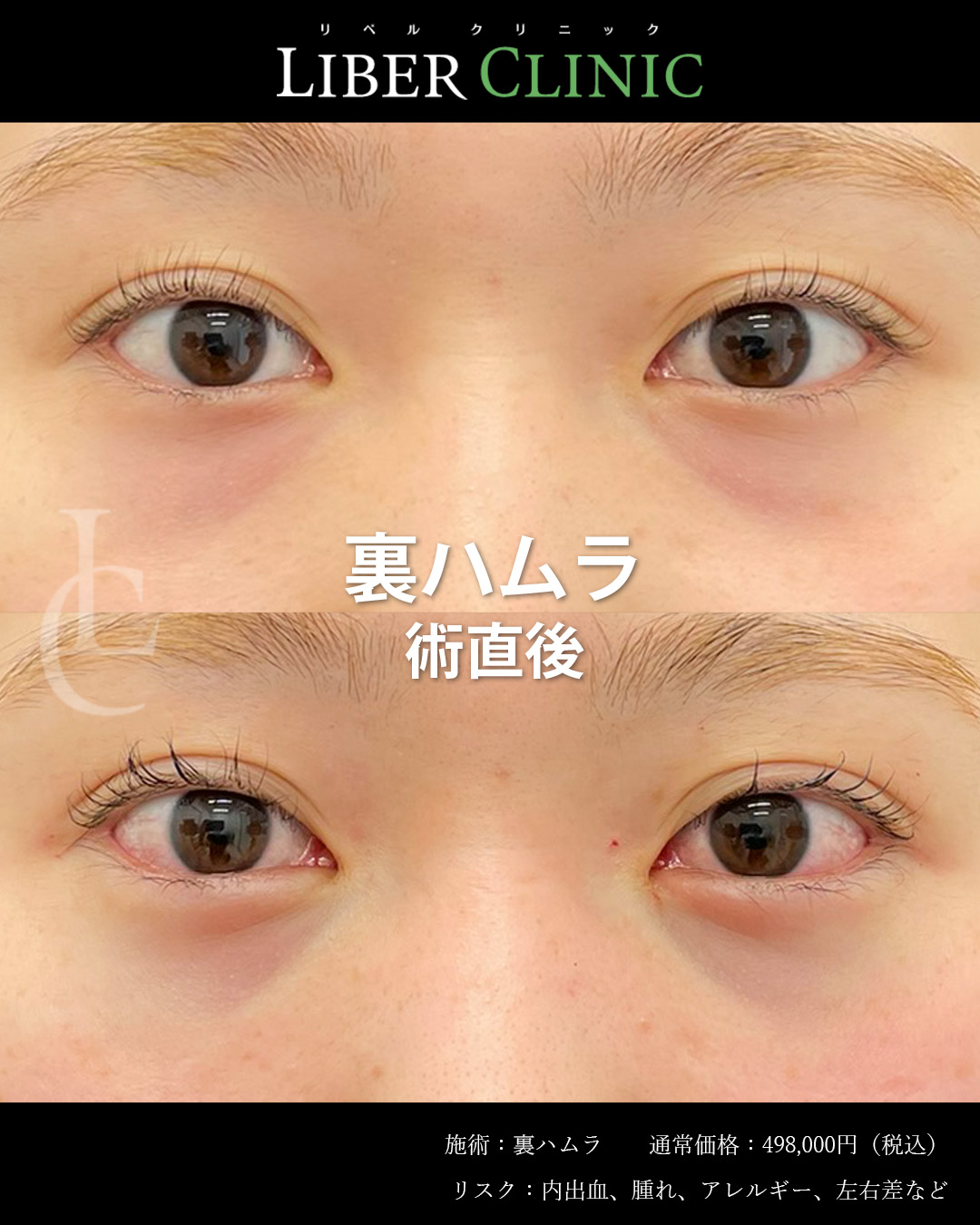 手術前と術直後