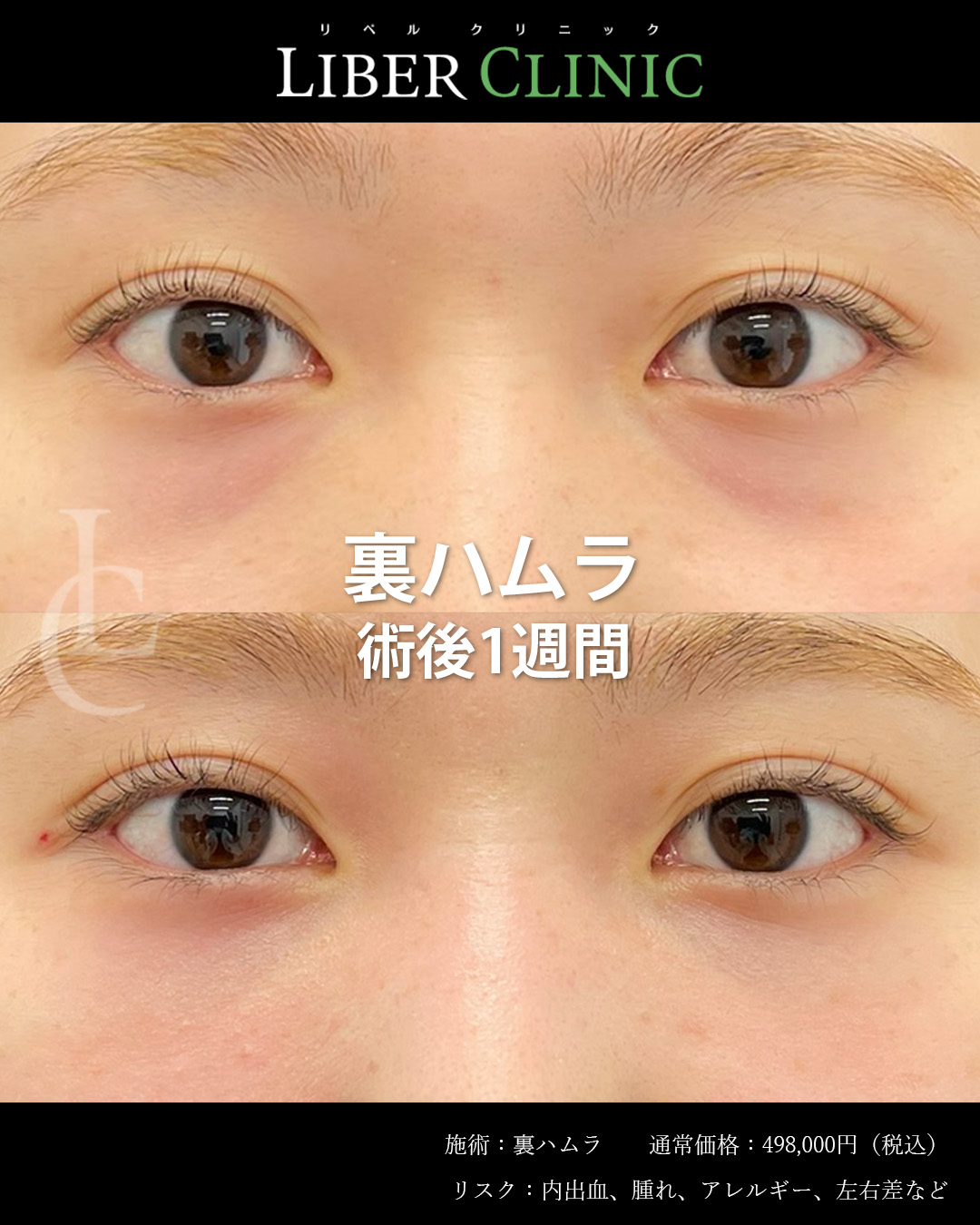手術前と術後1週間