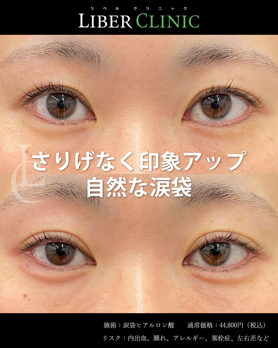 さりげなく印象アップ自然な涙袋