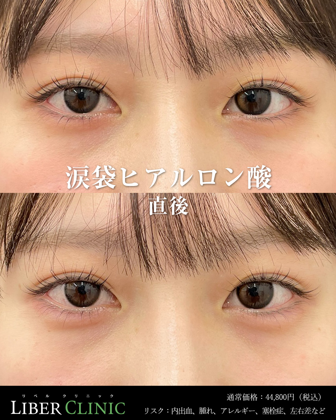 処置前と処置直後の症例