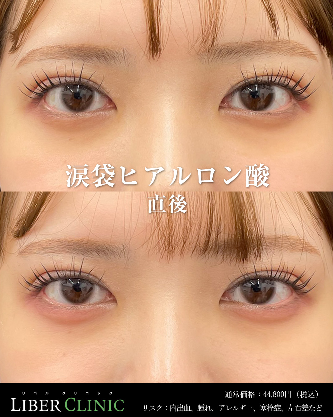 処置前と処置直後