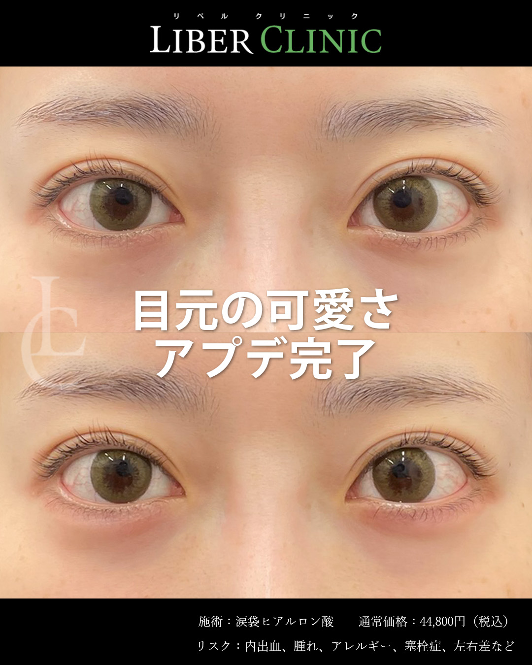 目元の可愛さアプデ完了