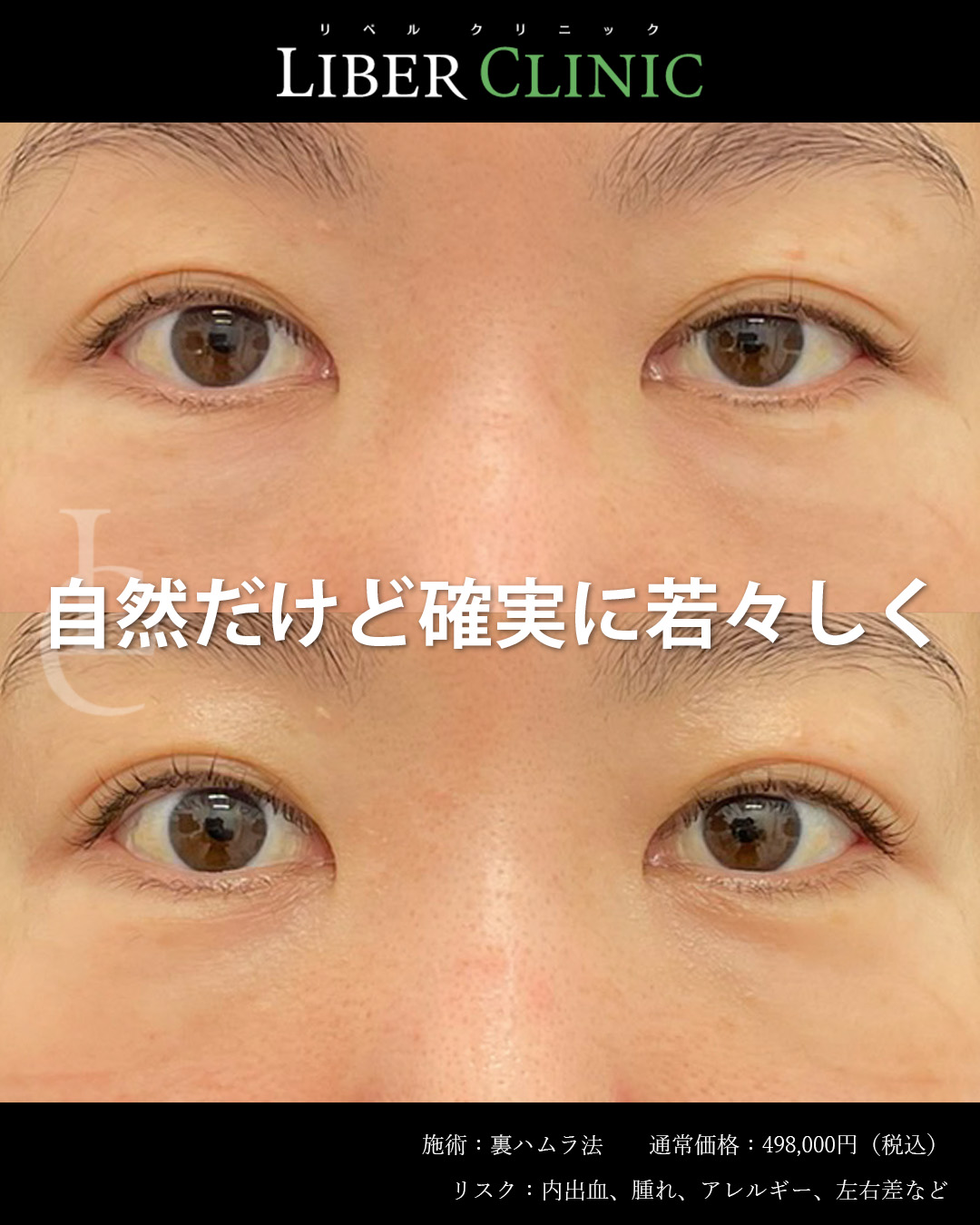 裏ハムラで自然だけど確実に若々しく