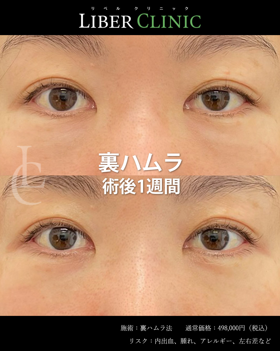 手術前と術後1週間