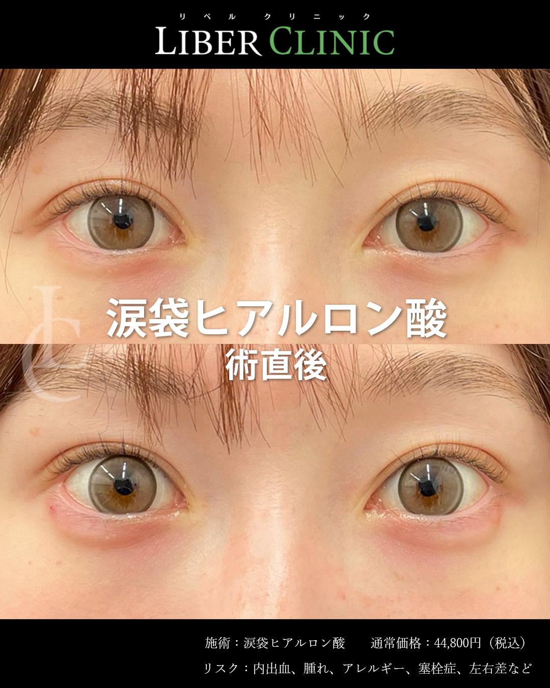 処置前と処置直後