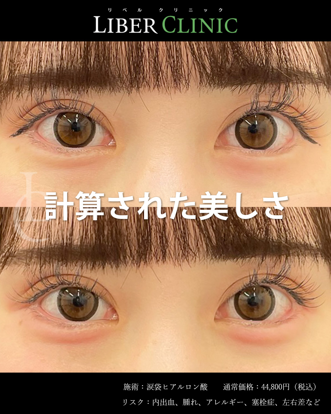 計算された美しさ
