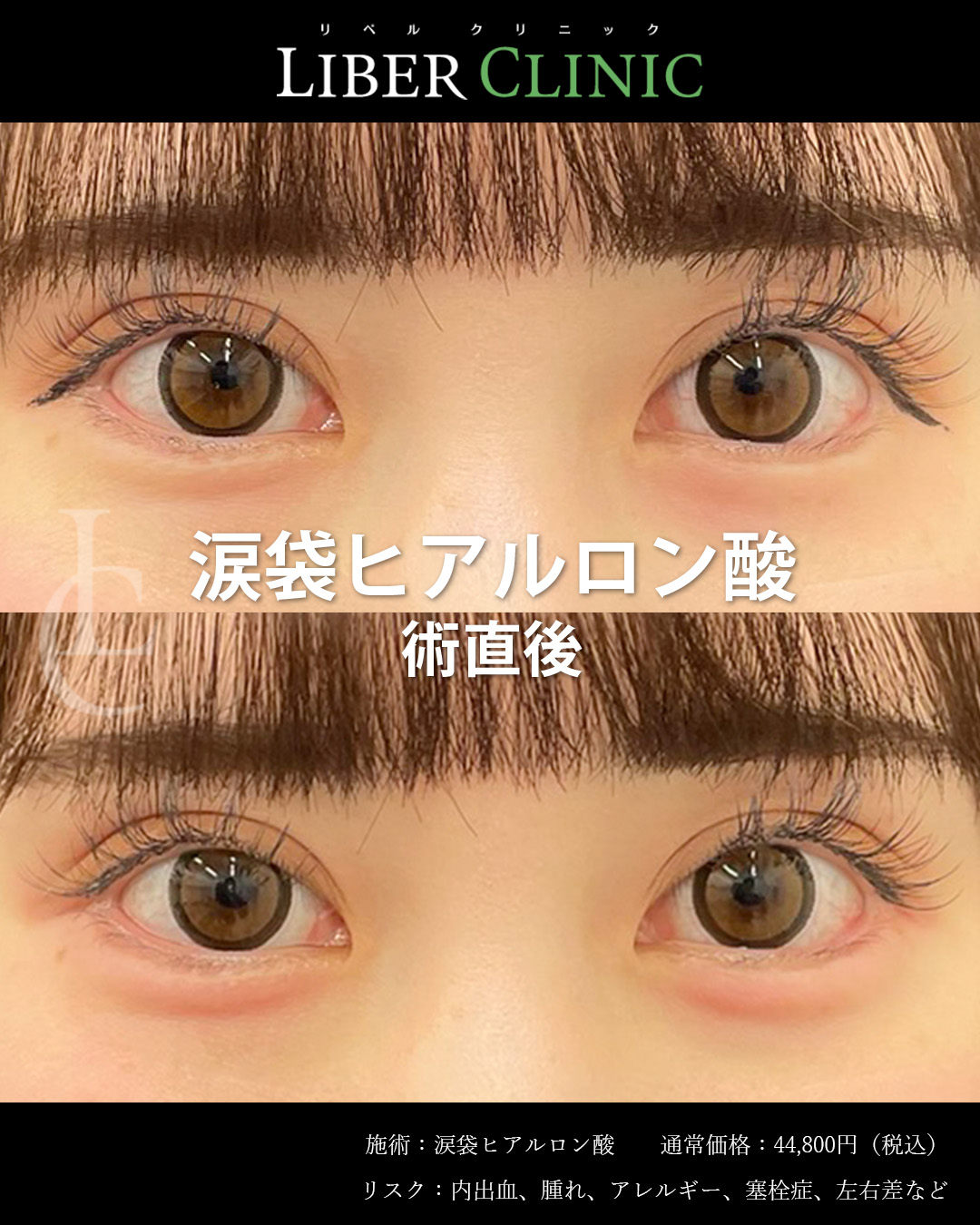 処置前と処置直後