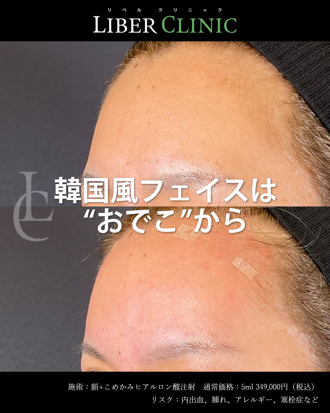斜めから見ても丸みが出ています