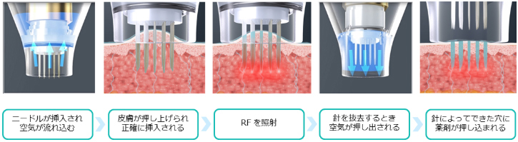 ポテンツァドラックデリバリー