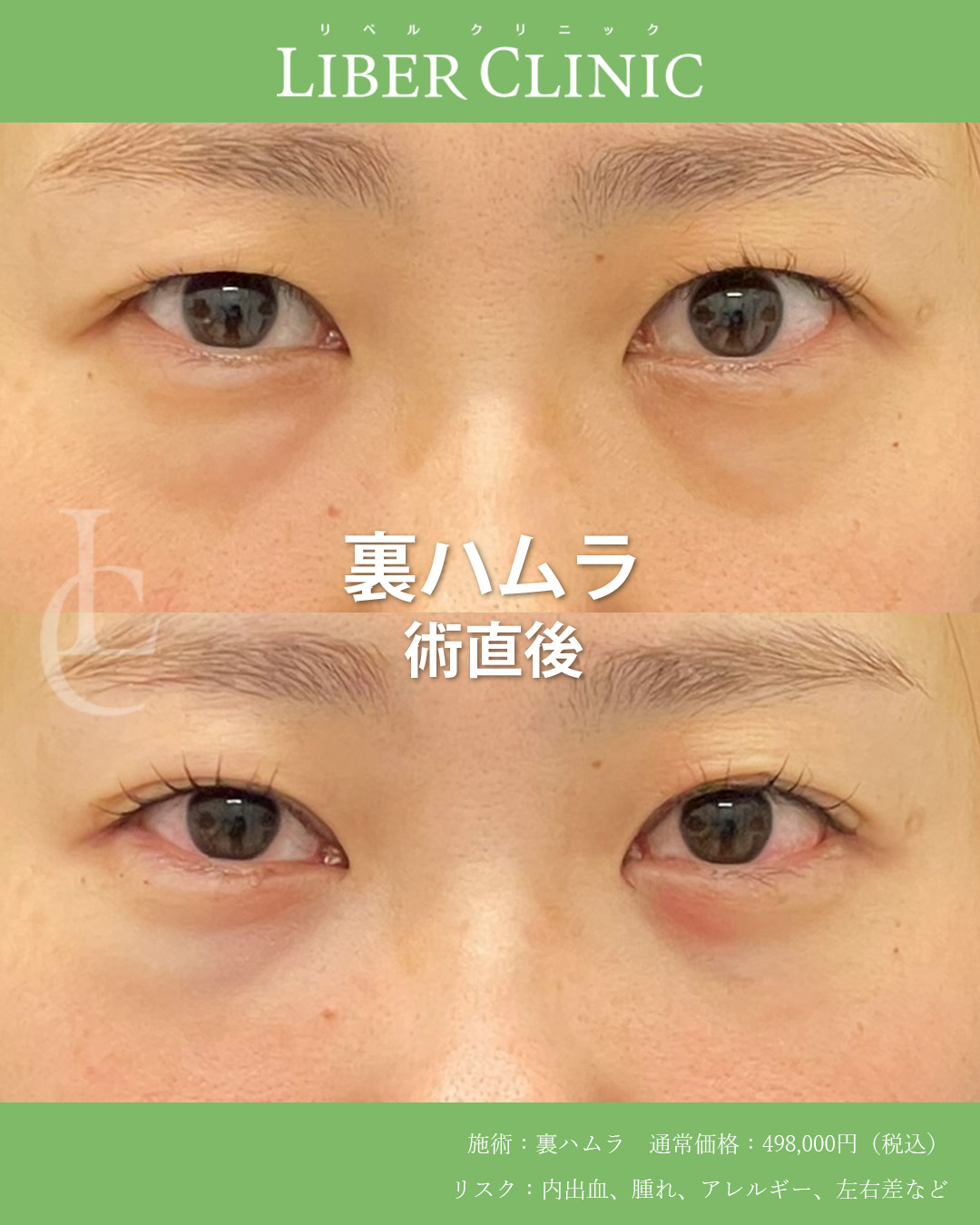 手術前と術直後