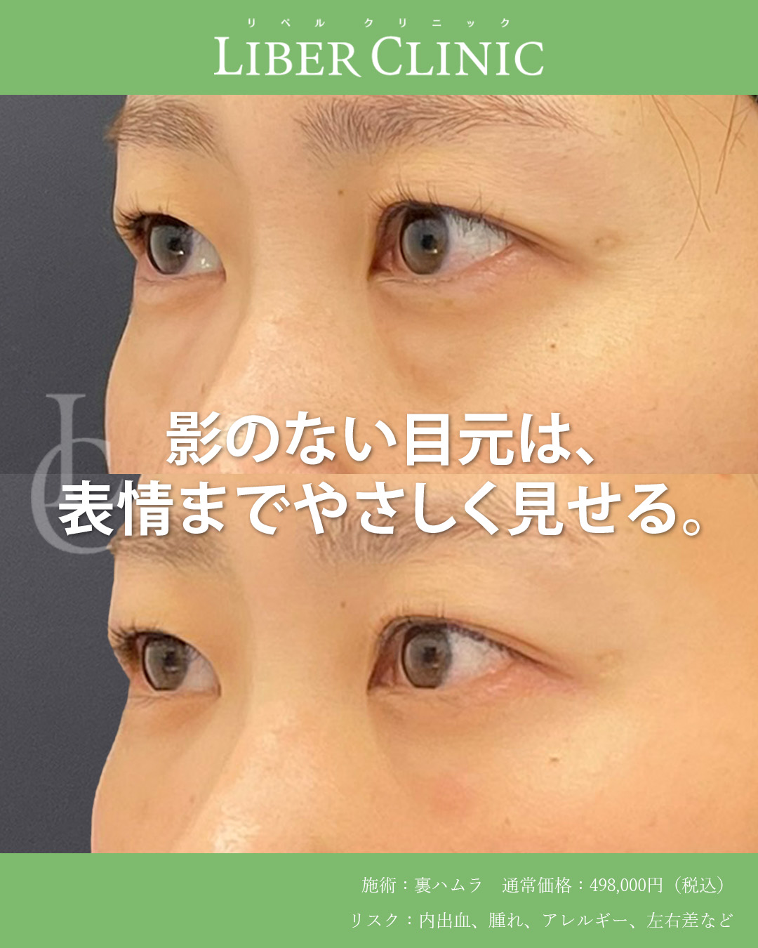 斜めから見ても変化が分かります