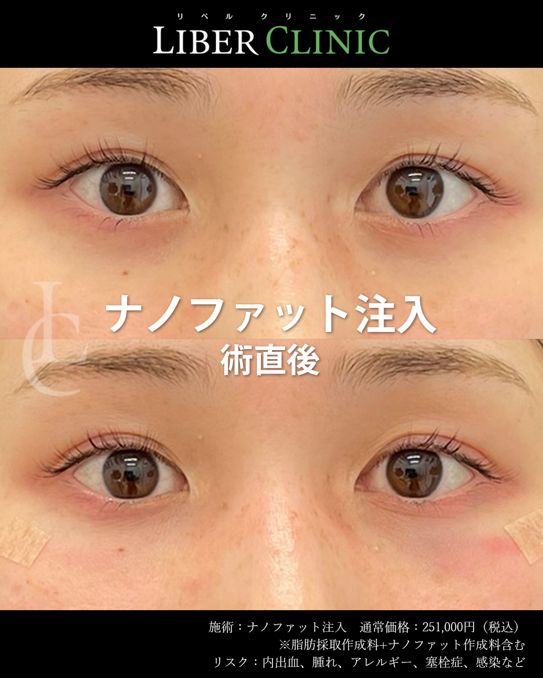 手術前と術直後