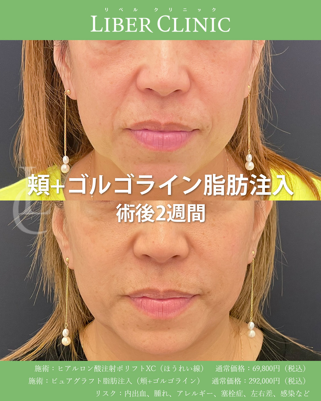 手術前と術後2週間