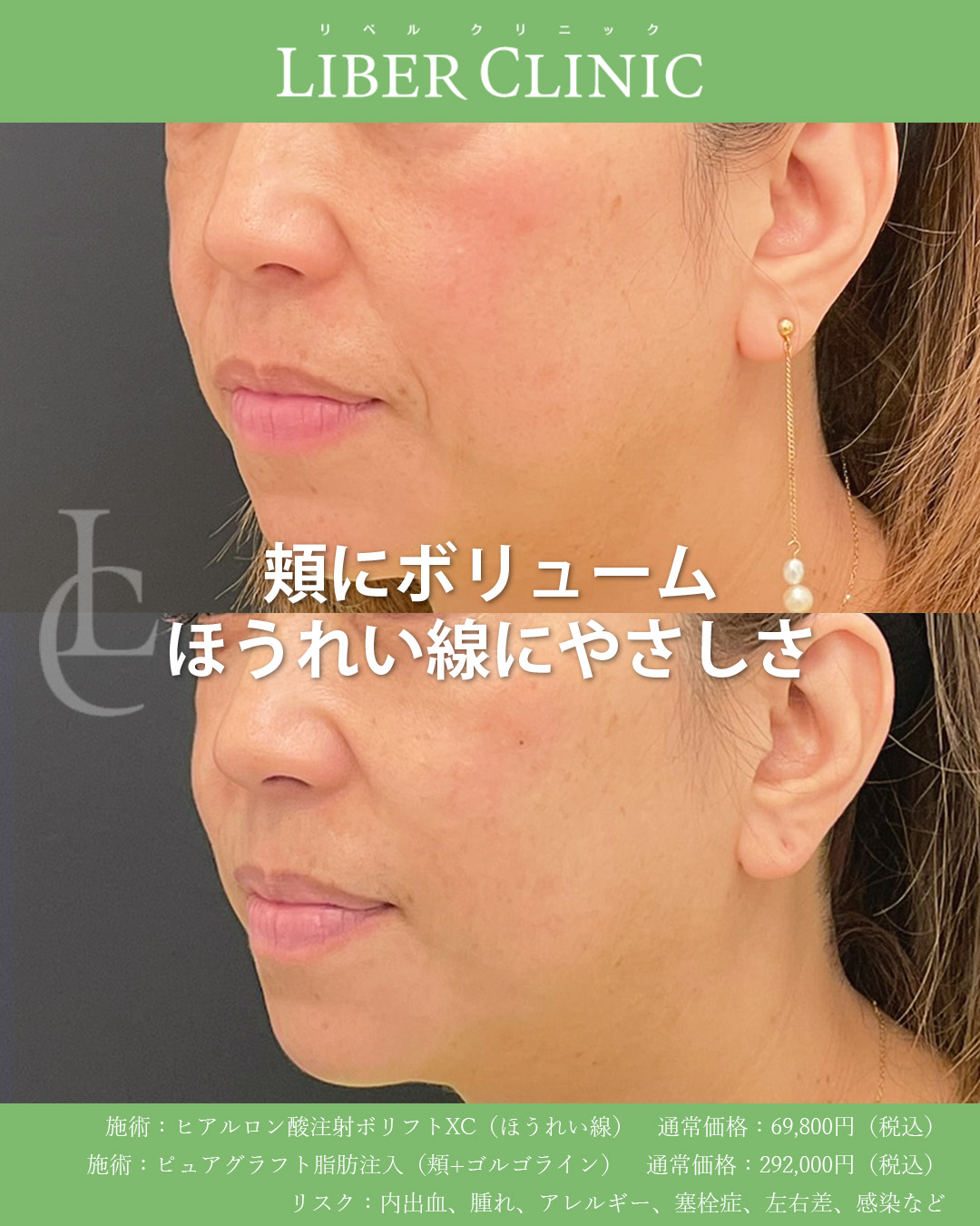 頬部分に注目