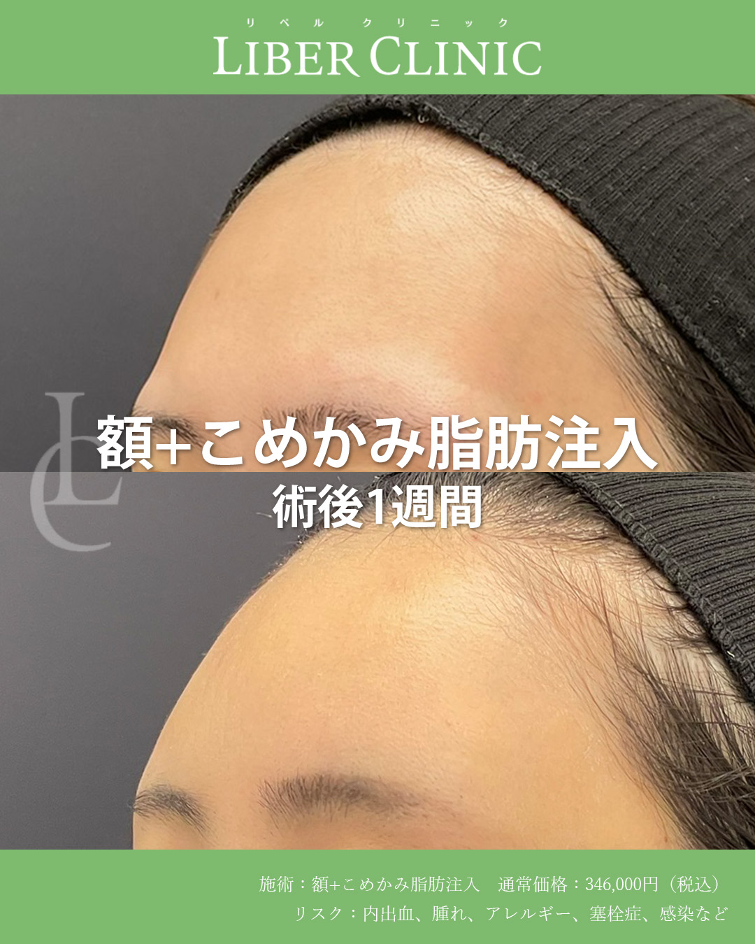 手術前と術後1週間