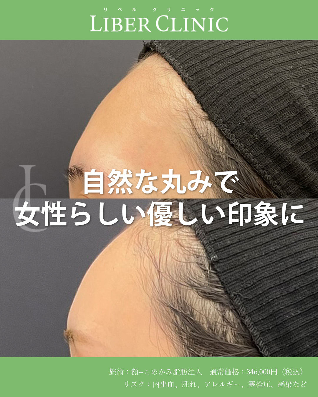 自然な丸みで女性らしい優しい印象に