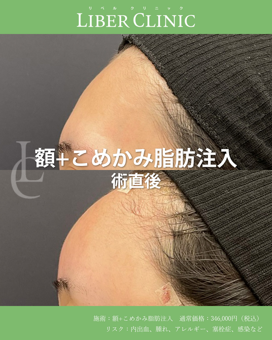 手術前と術直後