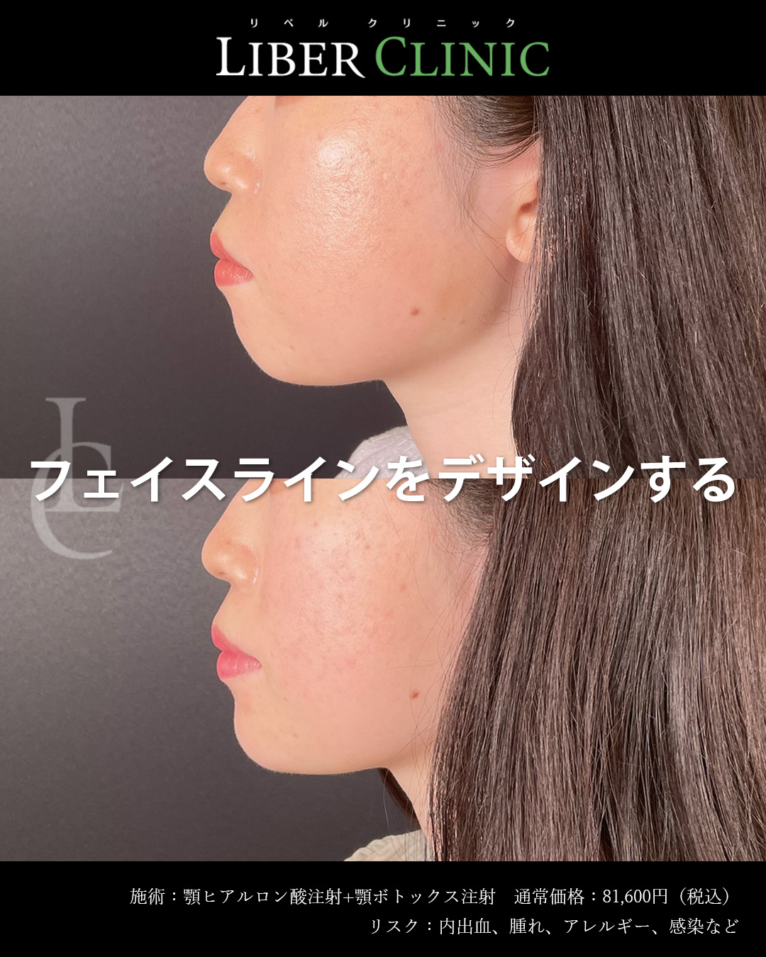 フェイスラインをデザインする