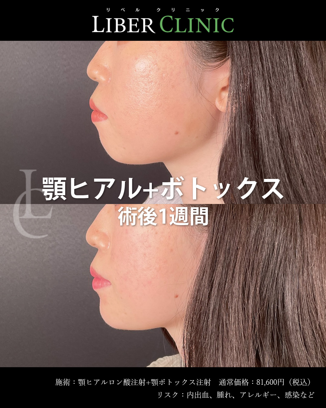 手術前と術後1週間