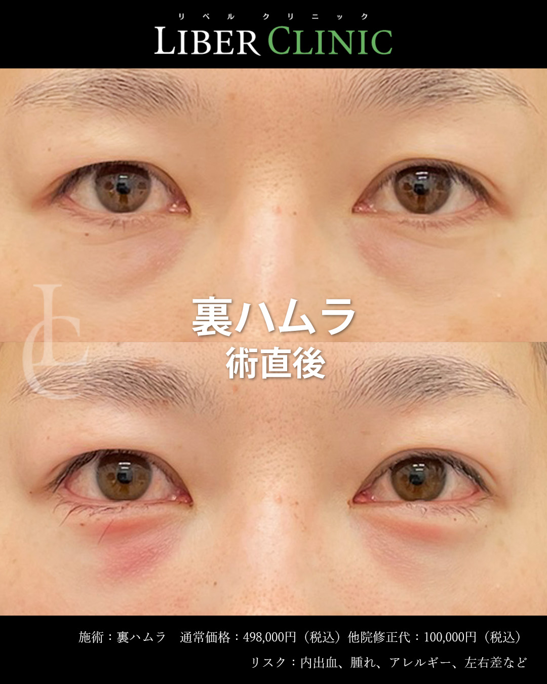 手術前と術直後