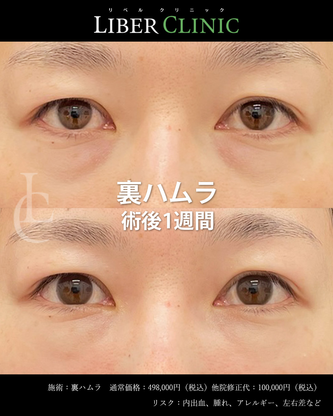 手術前と術後1週間