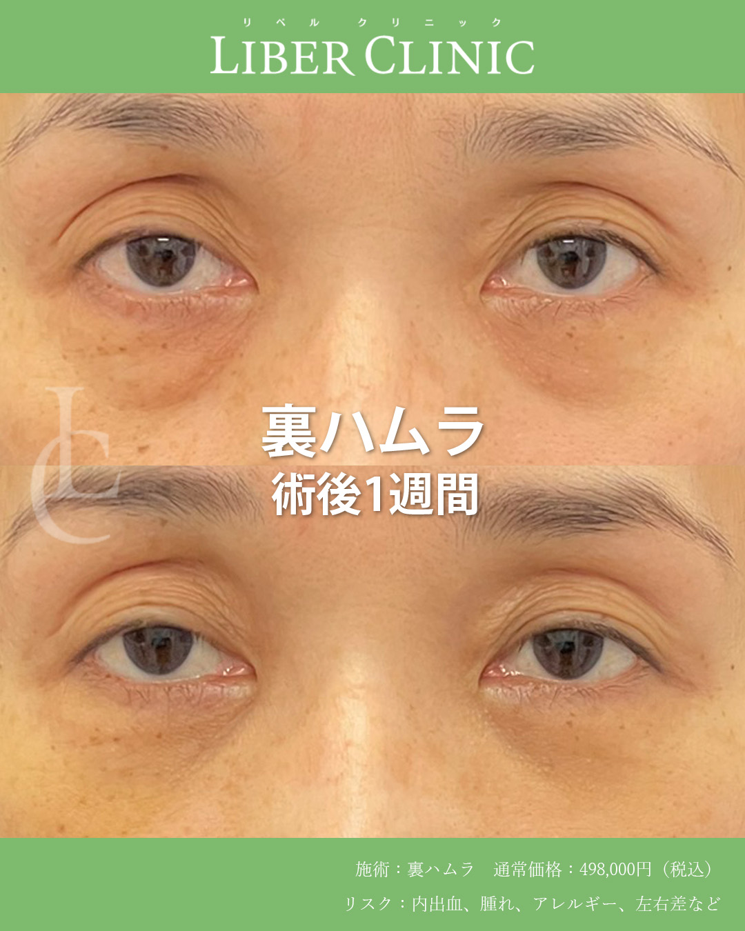 手術前と術後1週間