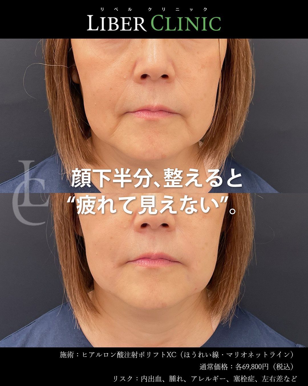 顔下半分、整えると“疲れて見えない”