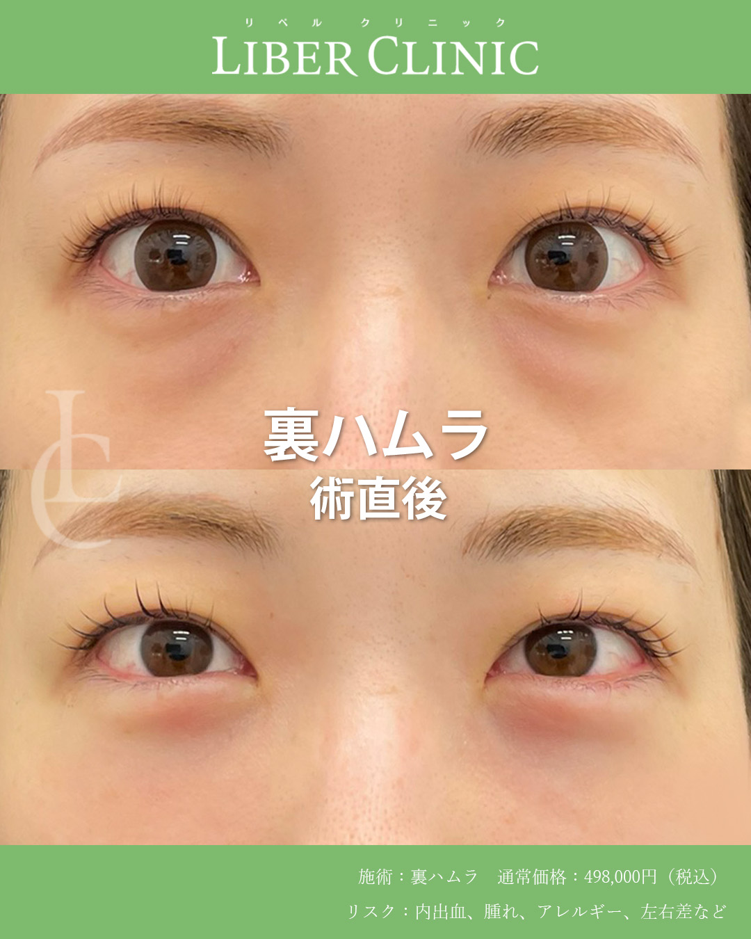 手術前と術直後