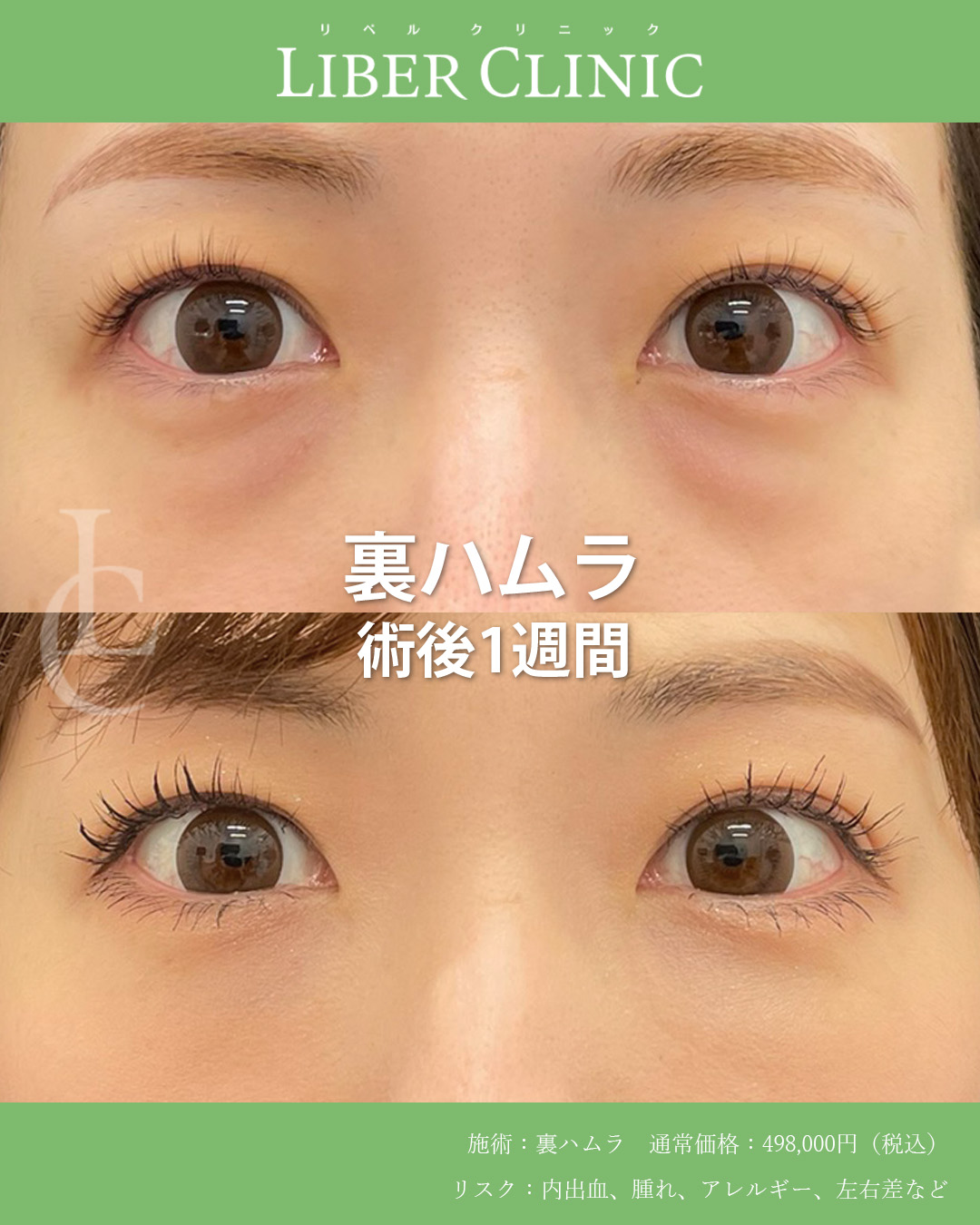 手術前と術後1週間