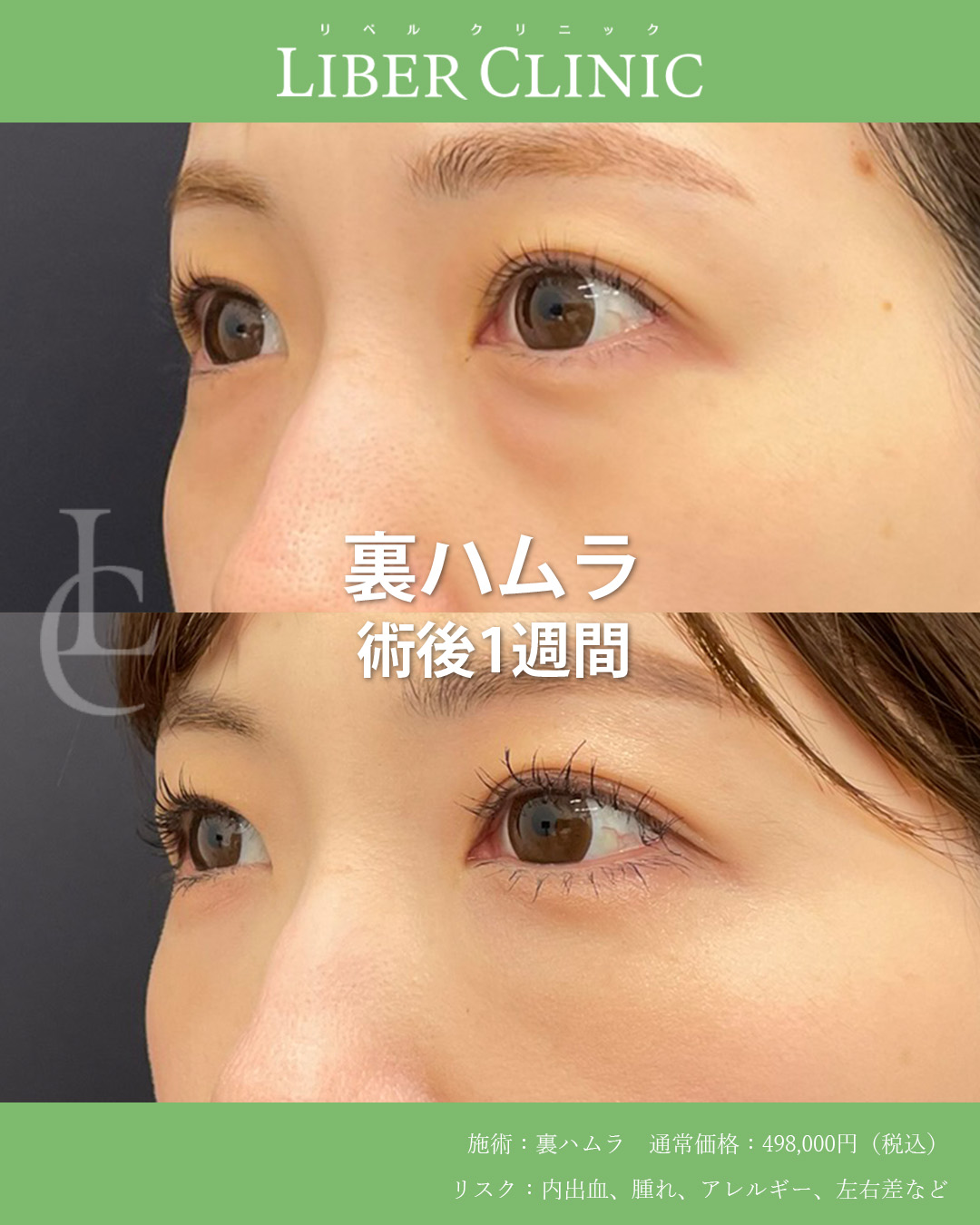 手術前と術後1週間