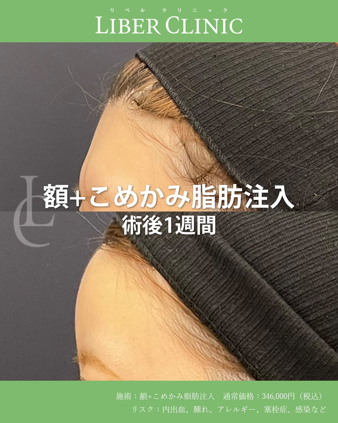 手術前と術後1週間
